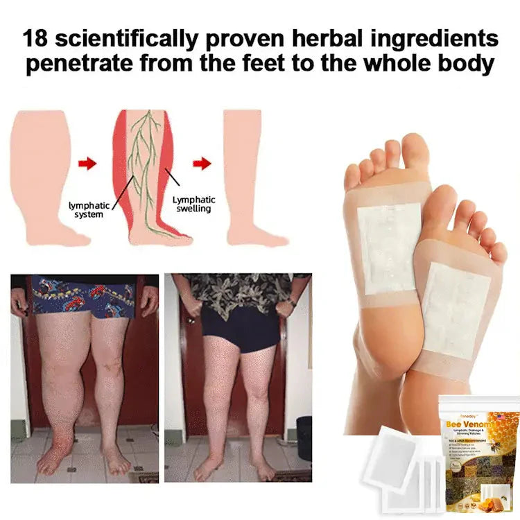 Bee Venom Lymphatic Detox Foot Patches (Set of 10) 🌿👣